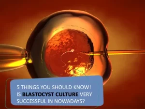 5 things you Should Know! Is Blastocyst Culture very Successful in Nowadays